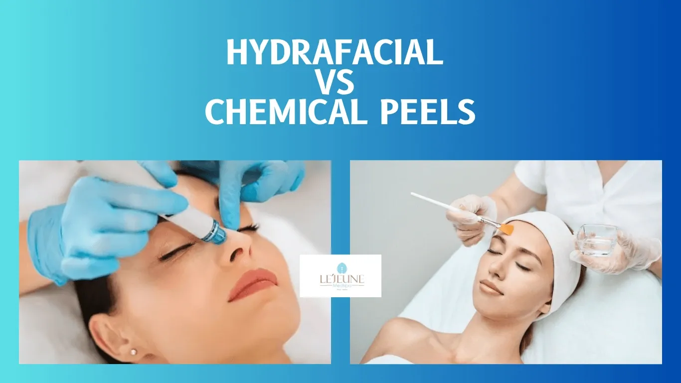 Hydrafacial vs Chemical Peels: Which One Is Right for You?